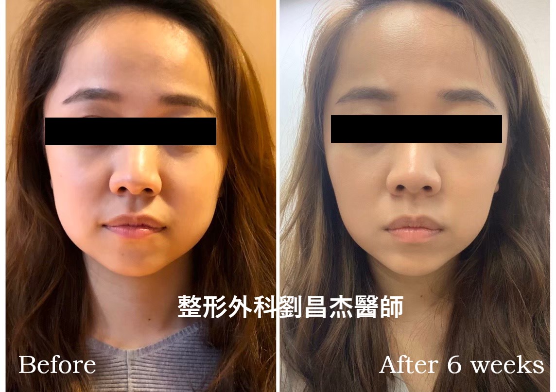 Dr Liu Blog-b1_b