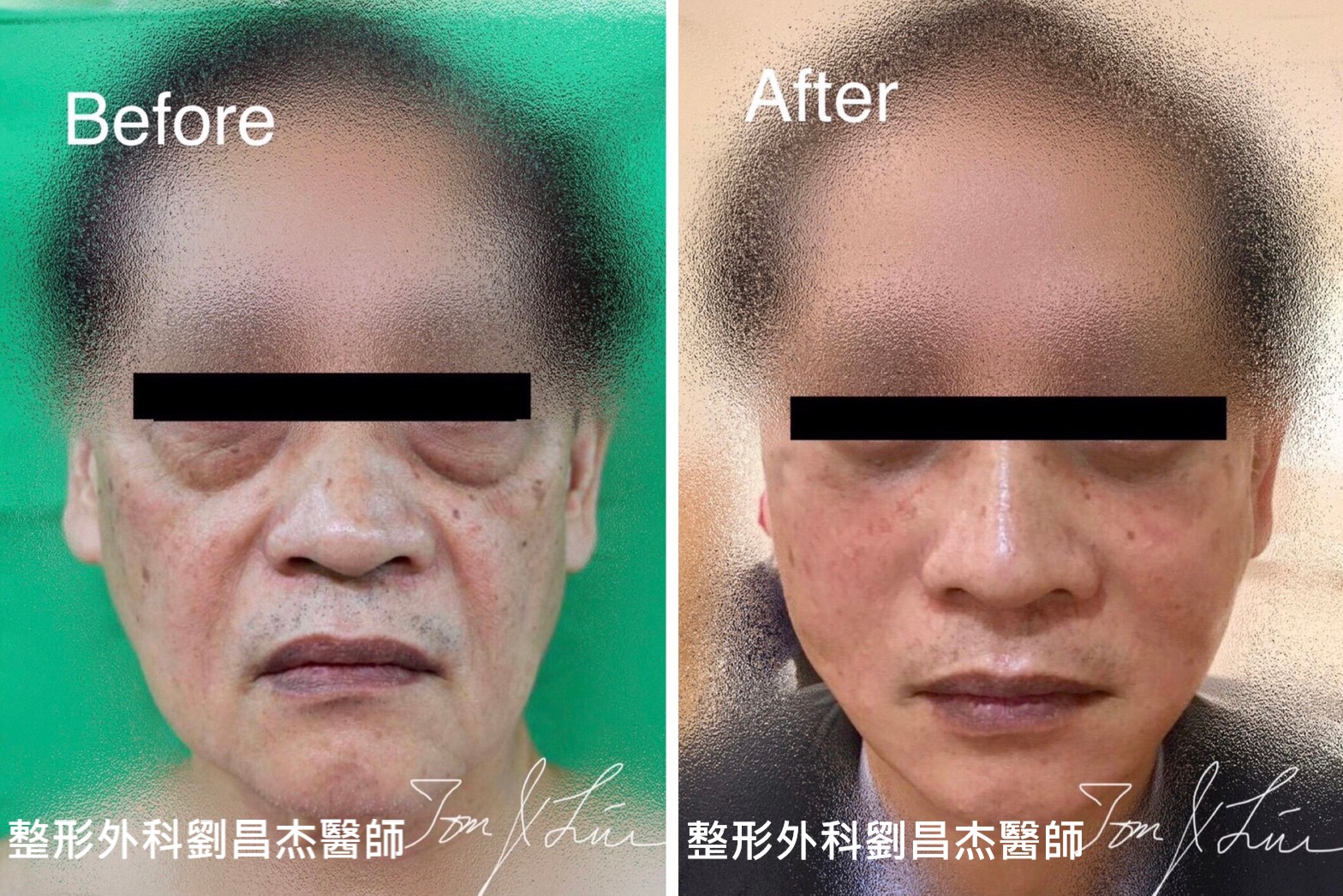 Dr Liu Blog-b4_b