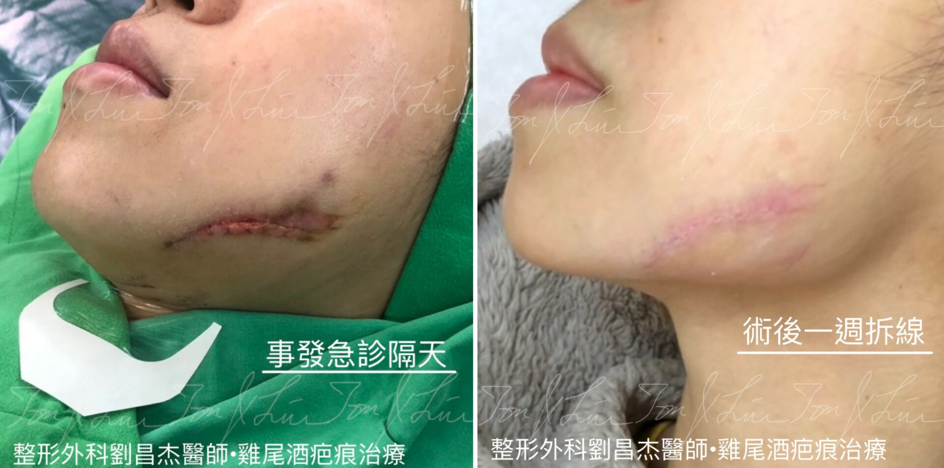Dr liu blog b5 2a