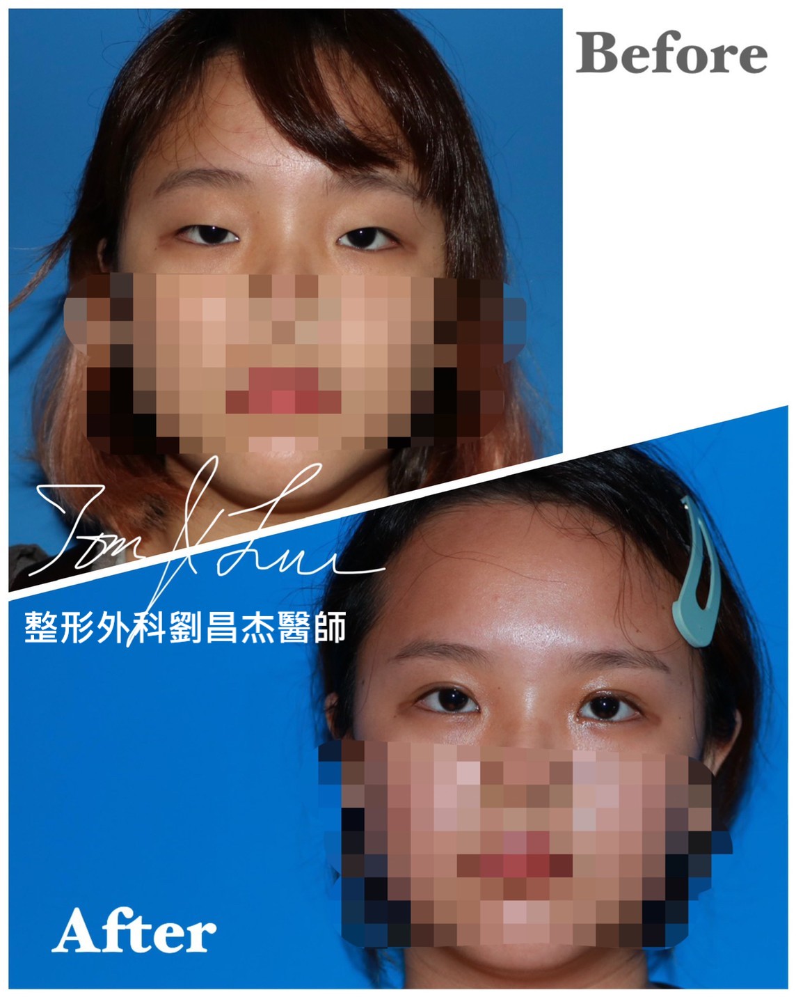 Dr Liu Blog-c1_1d