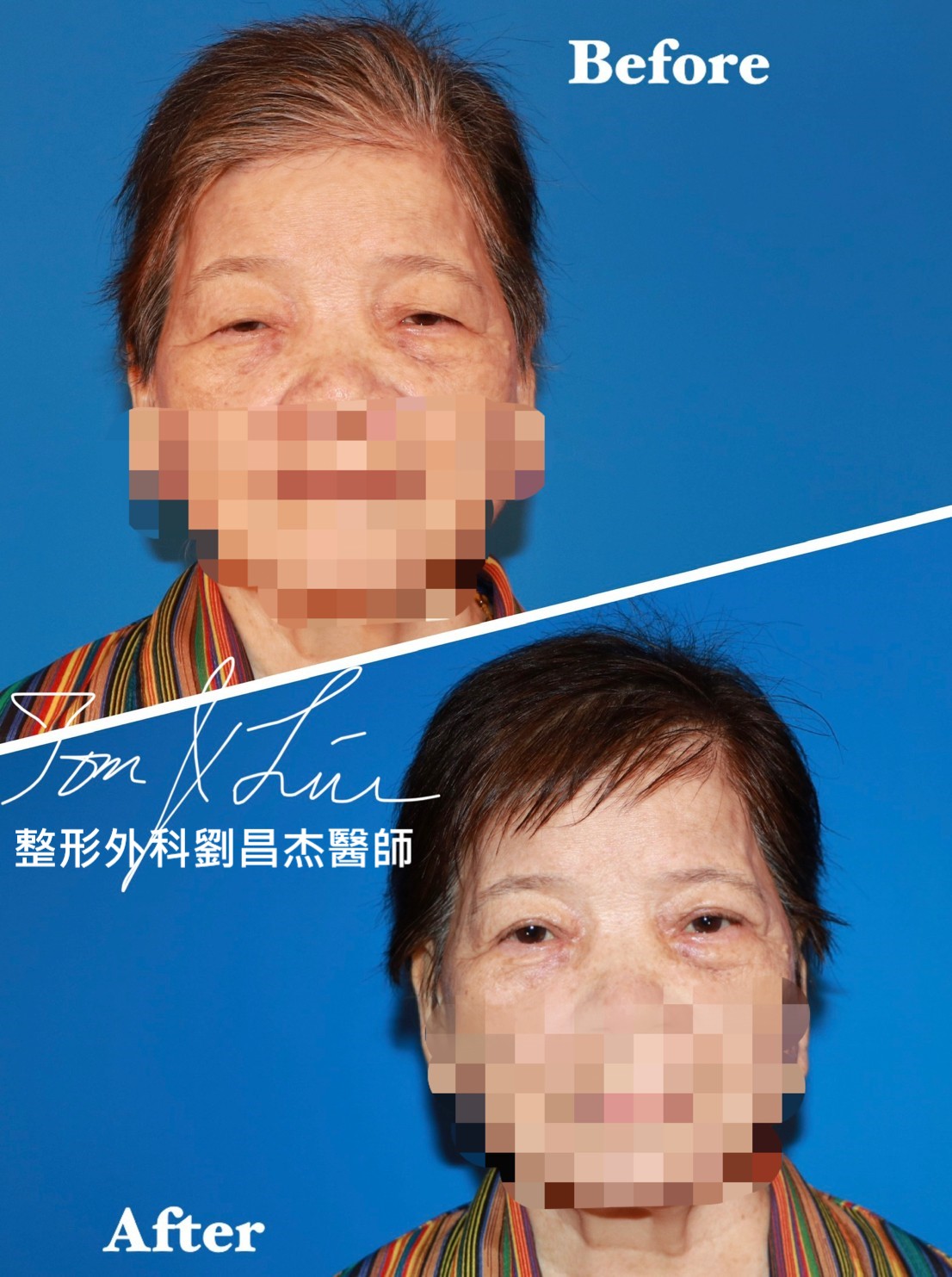 Dr Liu Blog-c1_1f