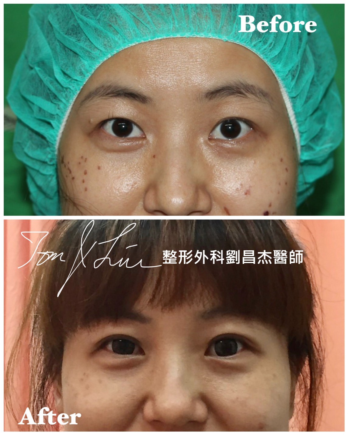 Dr Liu Blog-c1_1h