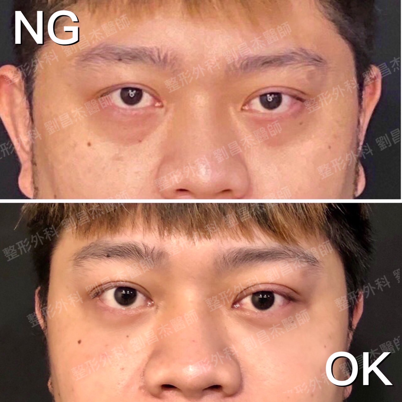 Dr Liu Blog-c2_2d