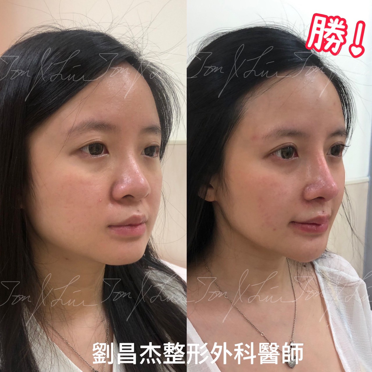 Dr Liu Blog-c3_1c