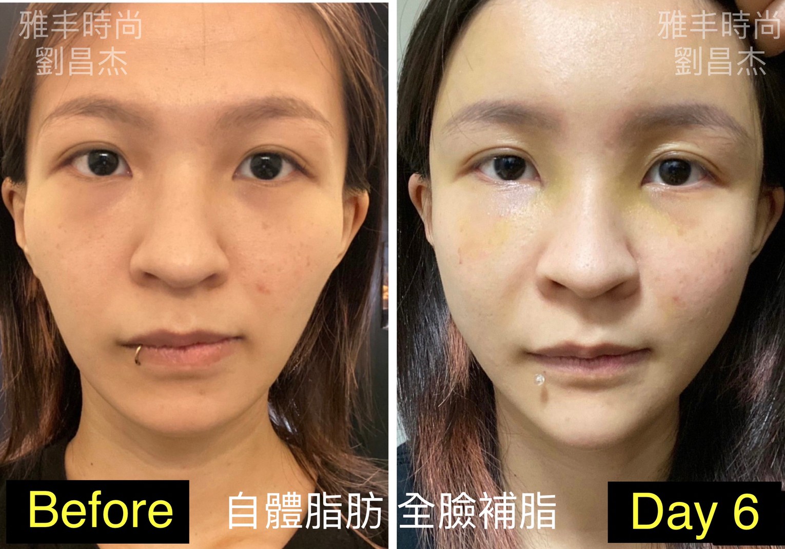 Dr Liu Blog-c4_2b