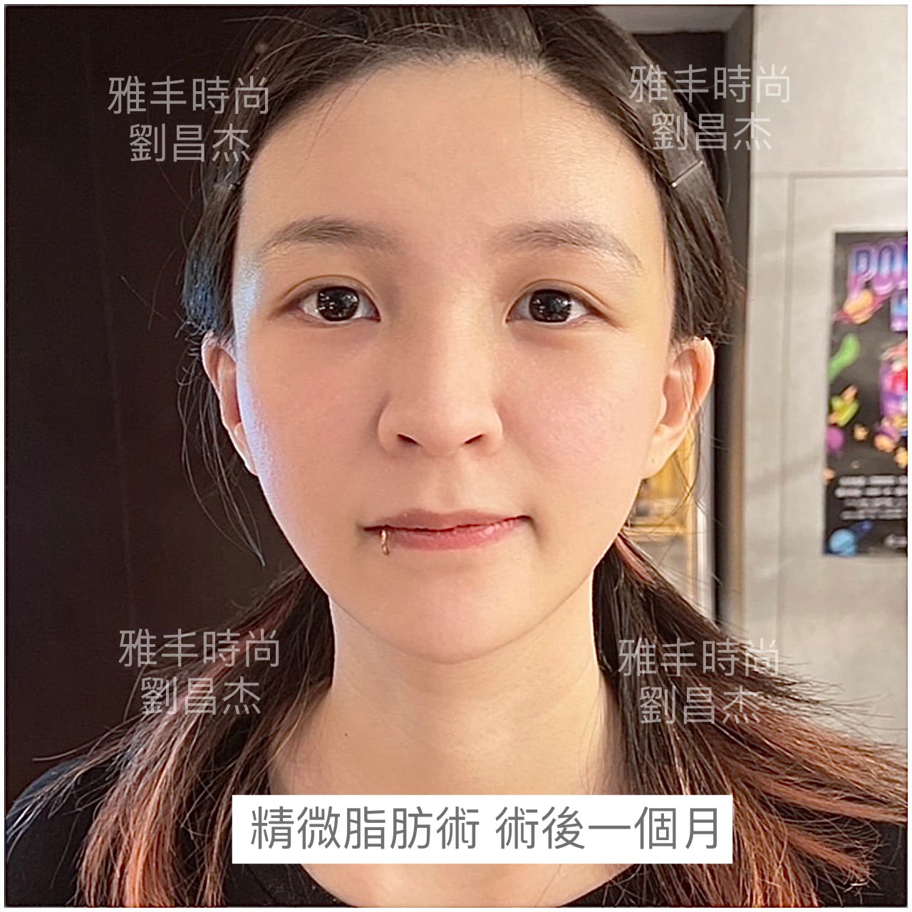 Dr Liu Blog-c4_2c