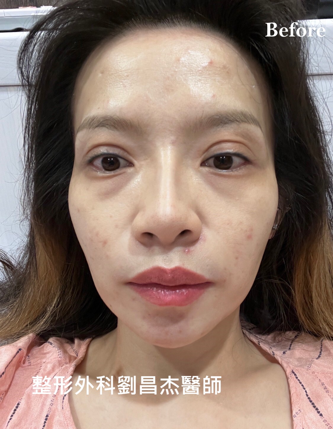 Dr liu blog c4 3a