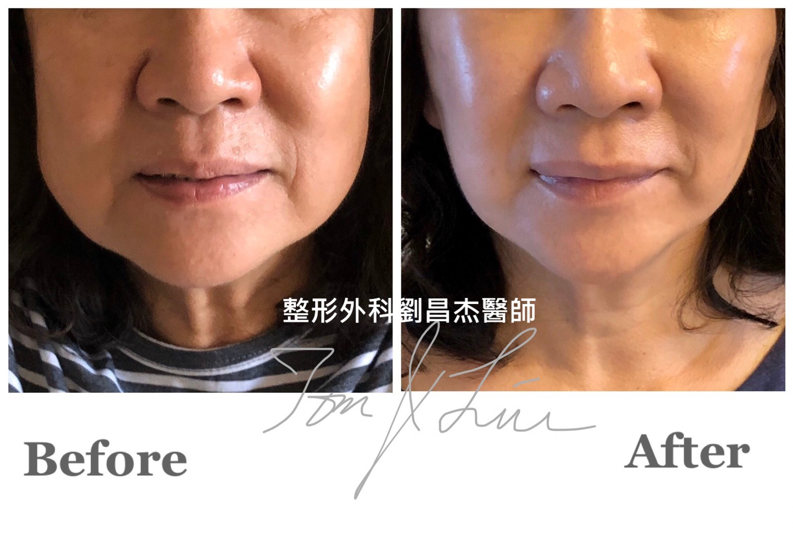 Dr Liu Blog c5 a