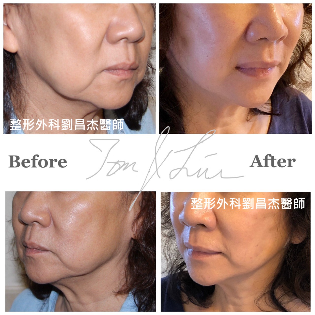 Dr Liu Blog-c5_b