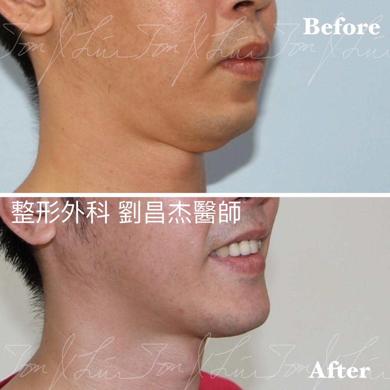 Dr Liu Blog c6 c