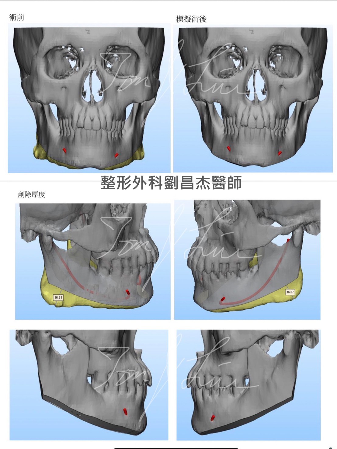 Dr Liu Blog-c7_a