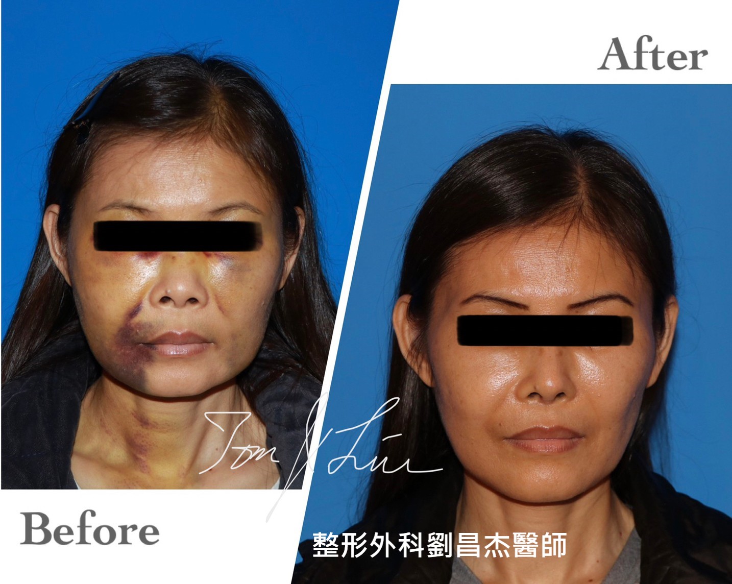 Dr Liu Blog c8 a