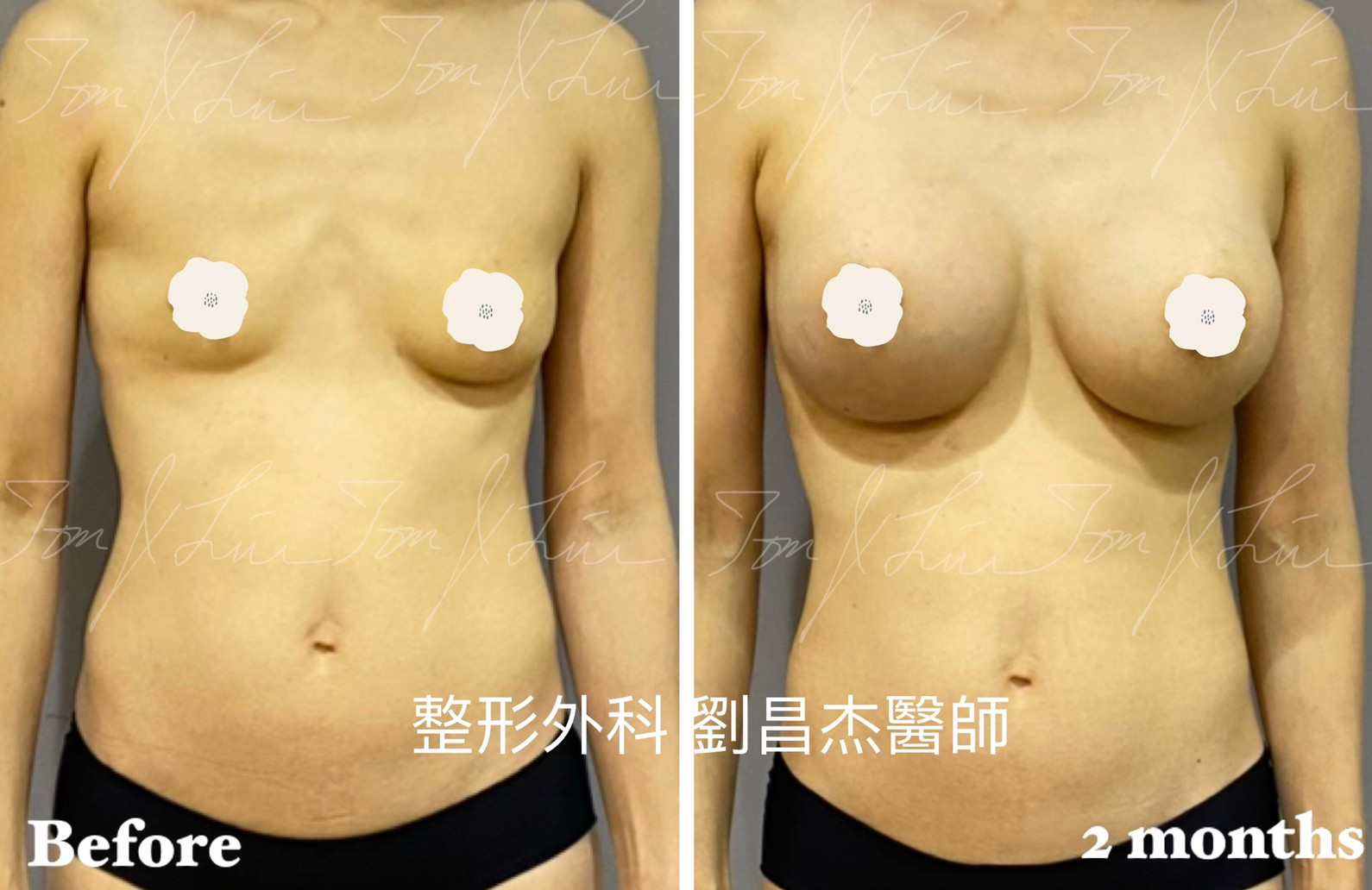 Dr Liu Blog d2 1a
