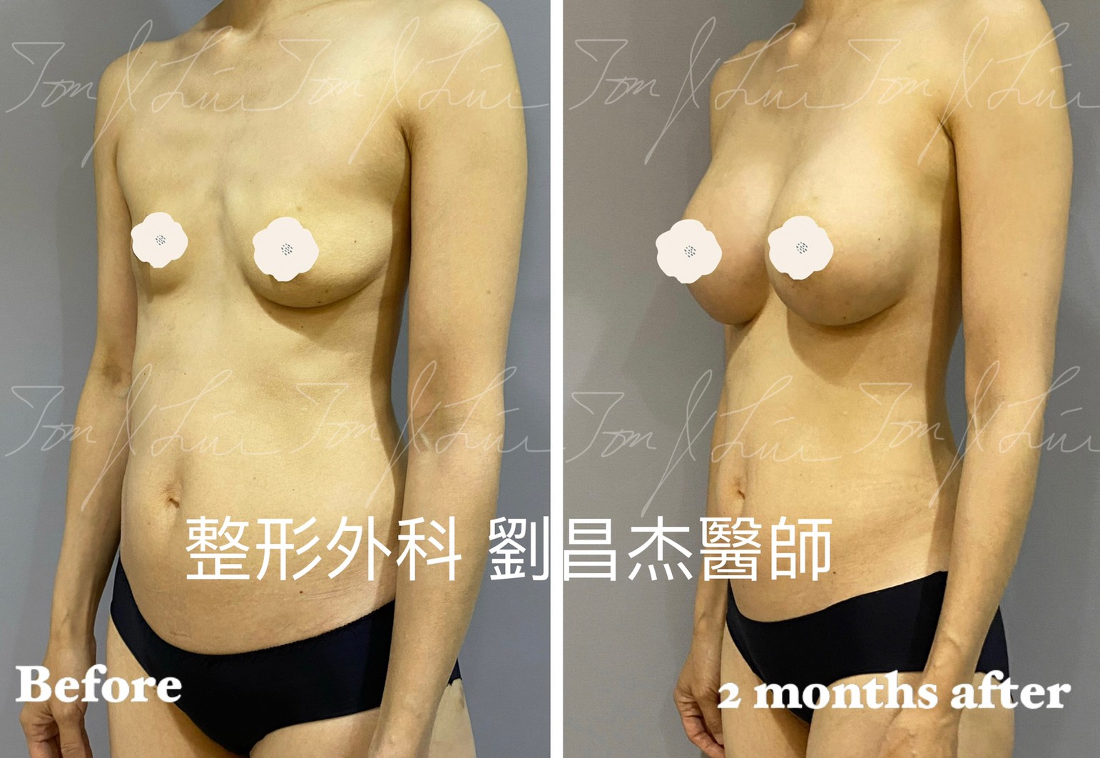 Dr Liu Blog-d2_1b