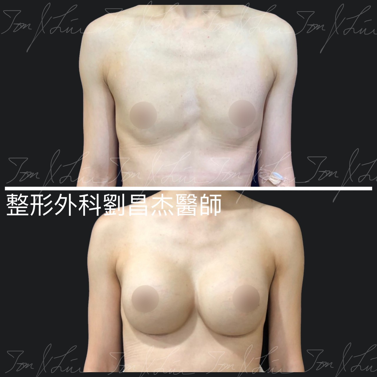 Dr Liu Blog d2 3a