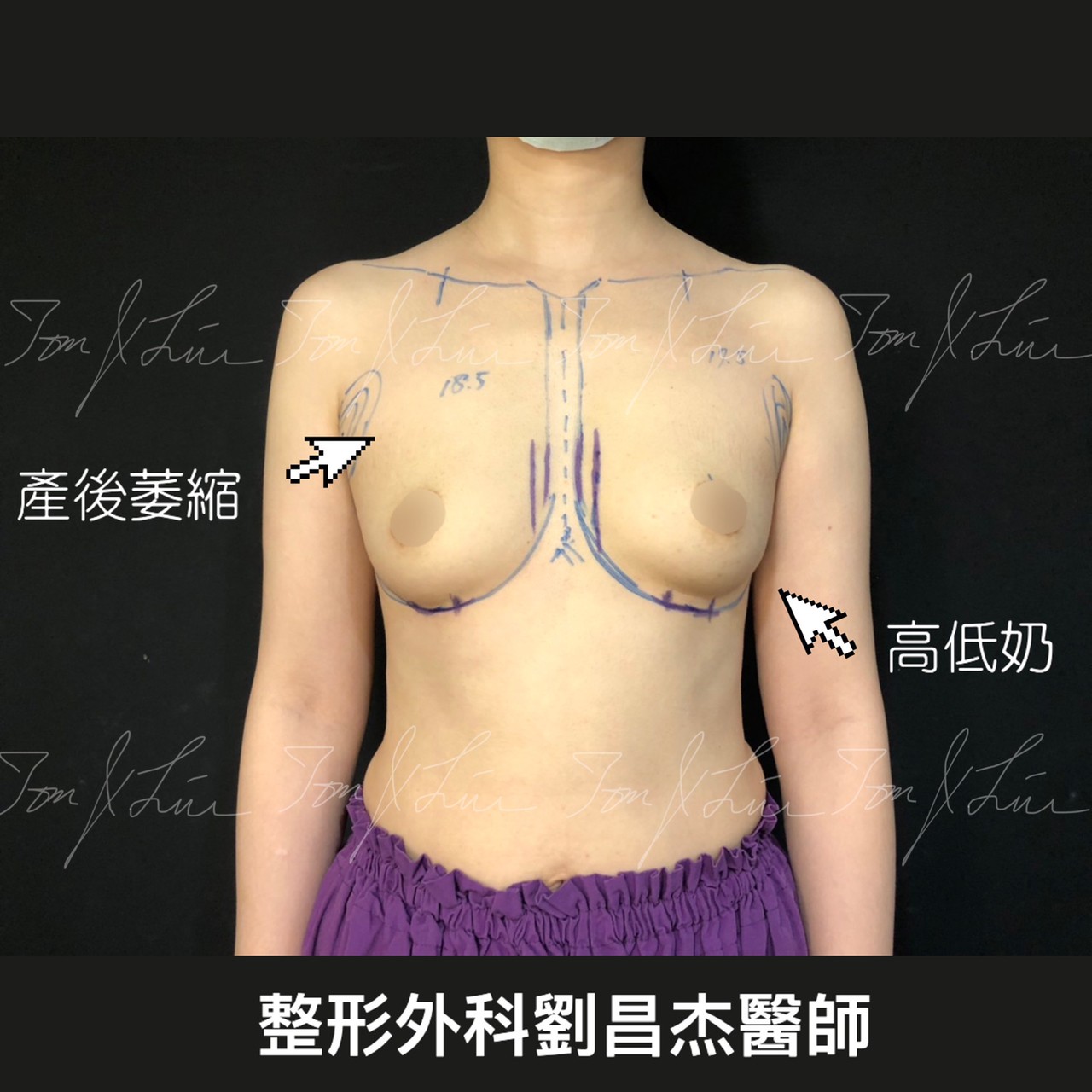 Dr Liu Blog-d2_4b