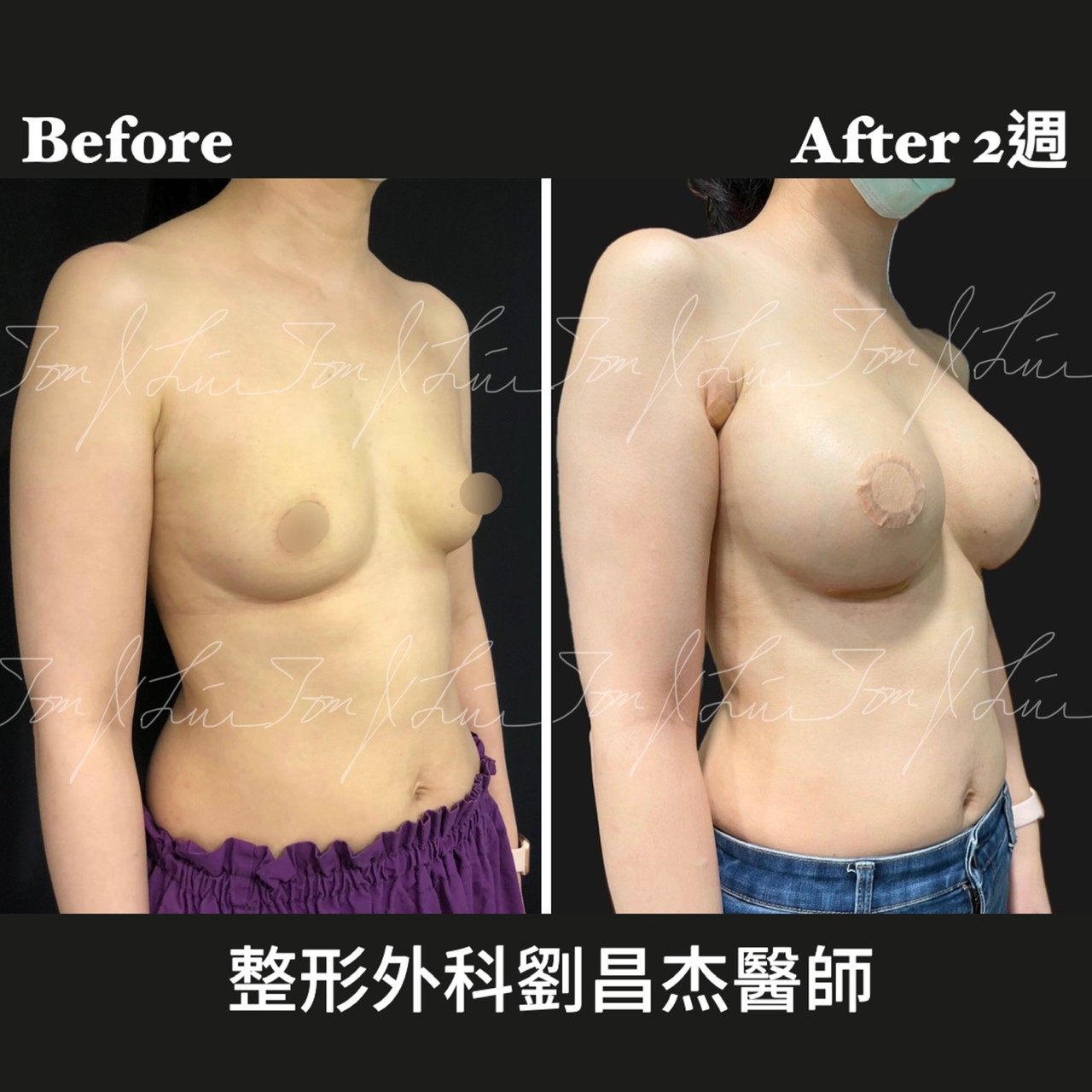 Dr Liu Blog-d2_4d