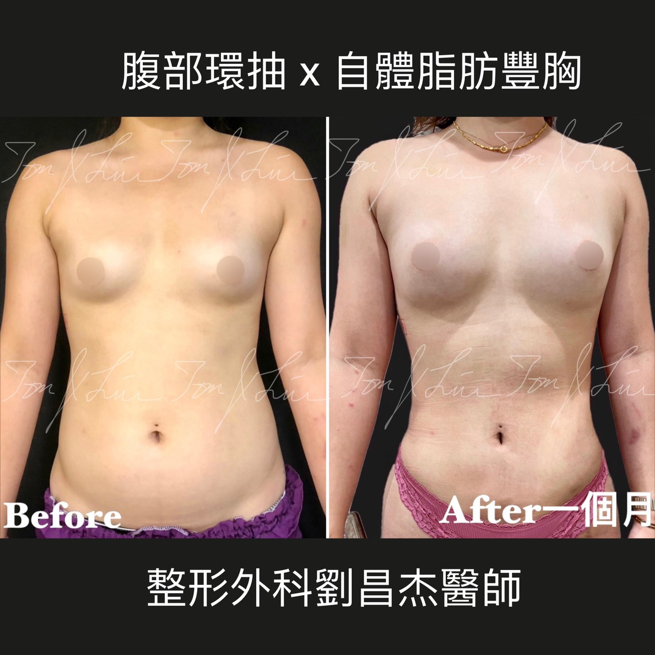 Dr liu blog d3 b