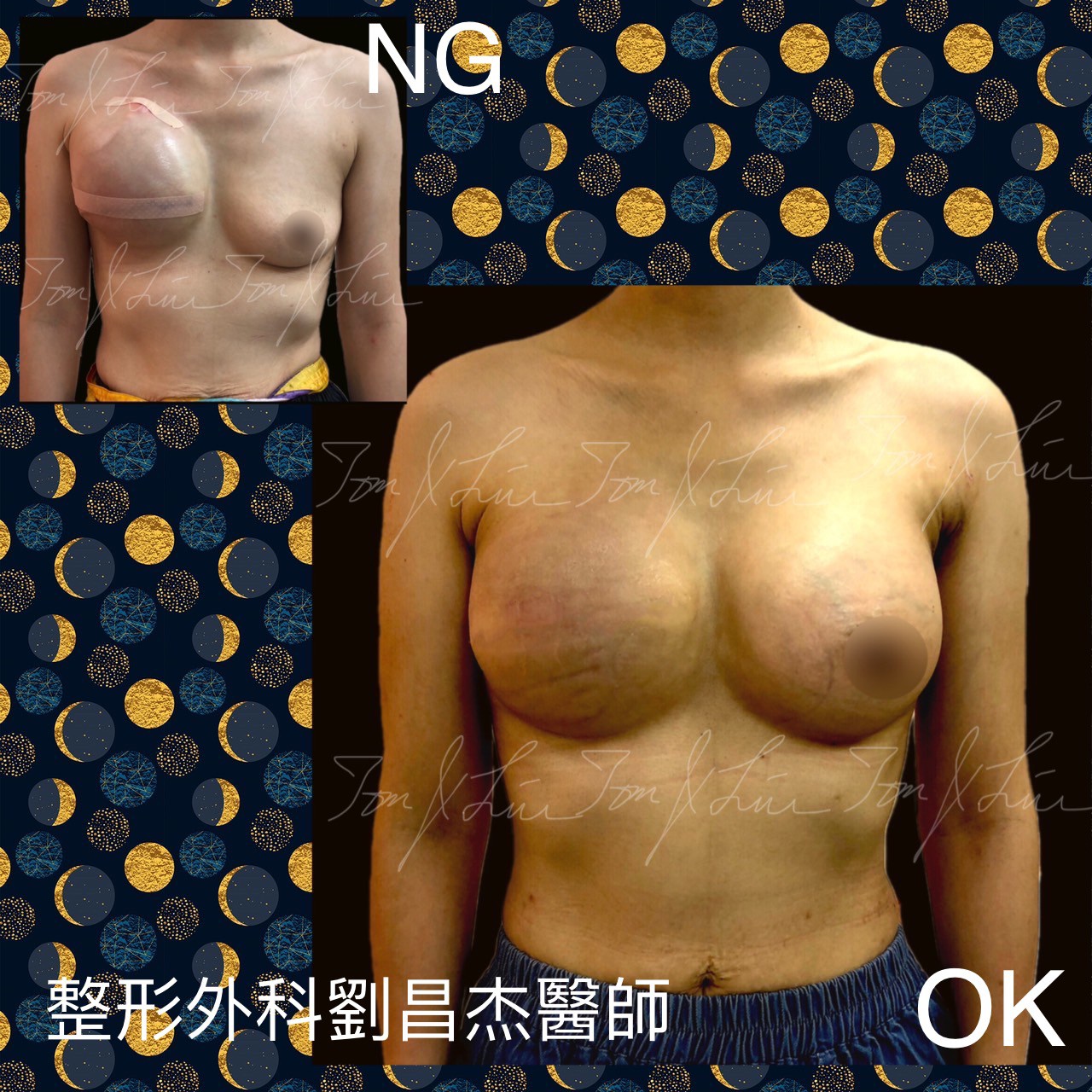 Dr liu blog e2 a