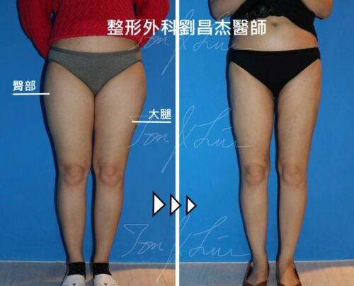 Dr Liu Blog-f1_b