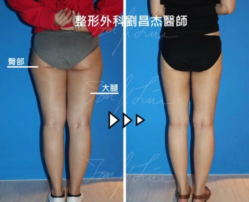 Dr Liu Blog-f1_c