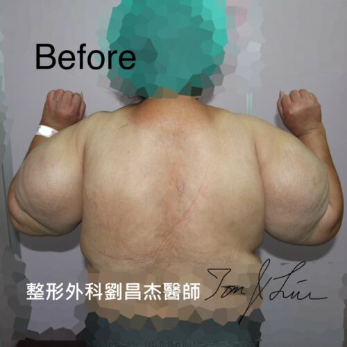 Dr Liu Blog-f1_d