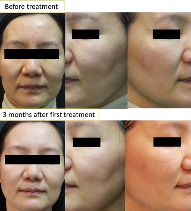 Dr Liu Blog-g2_2b