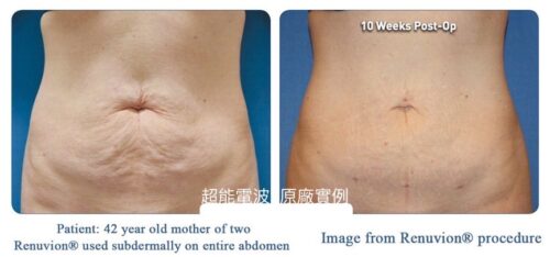 Dr Liu Blog-g6_d