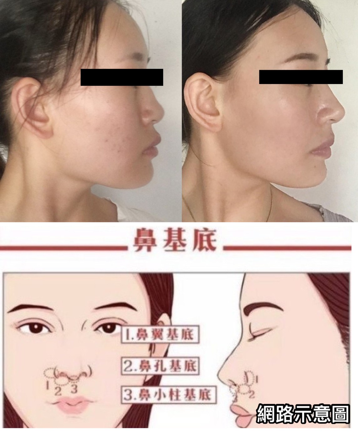 Dr liu blog h1 a