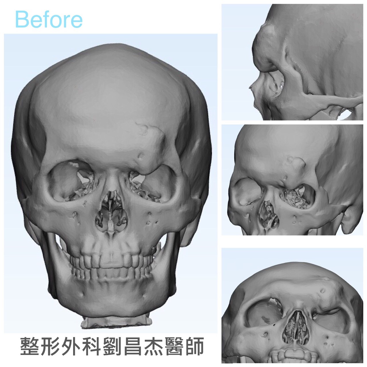Dr Liu Blog-h4_b