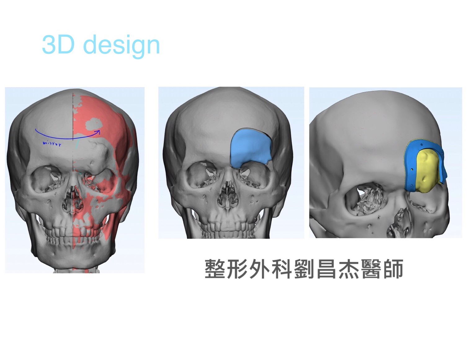 Dr Liu Blog-h4_c