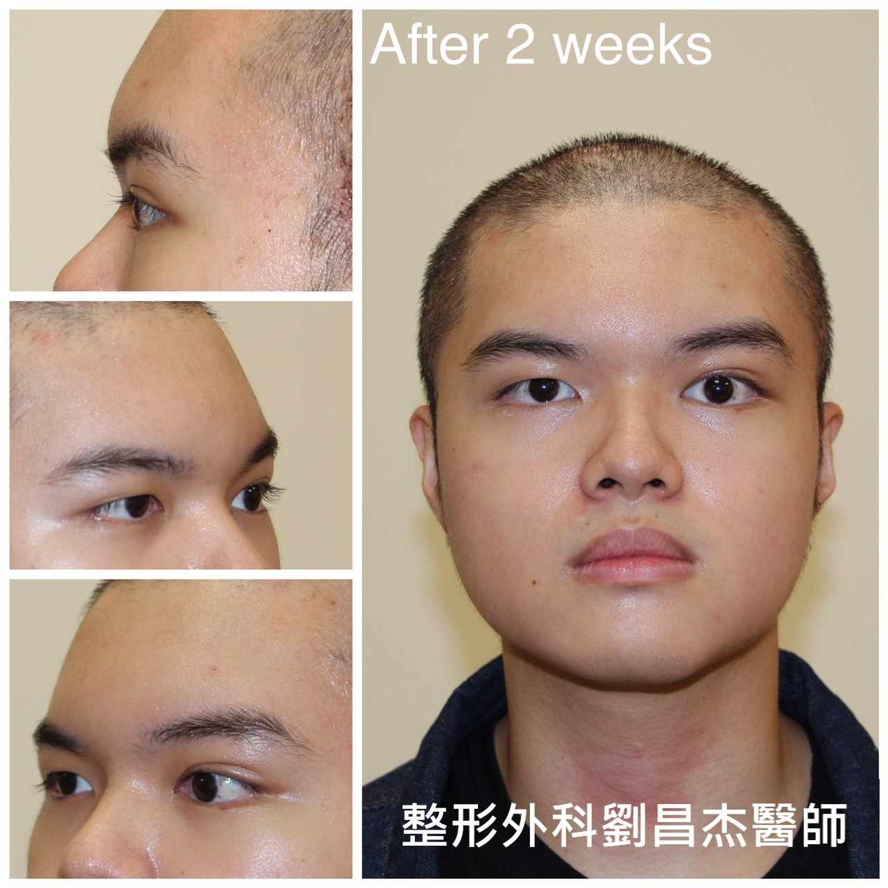 Dr Liu Blog-h4_d