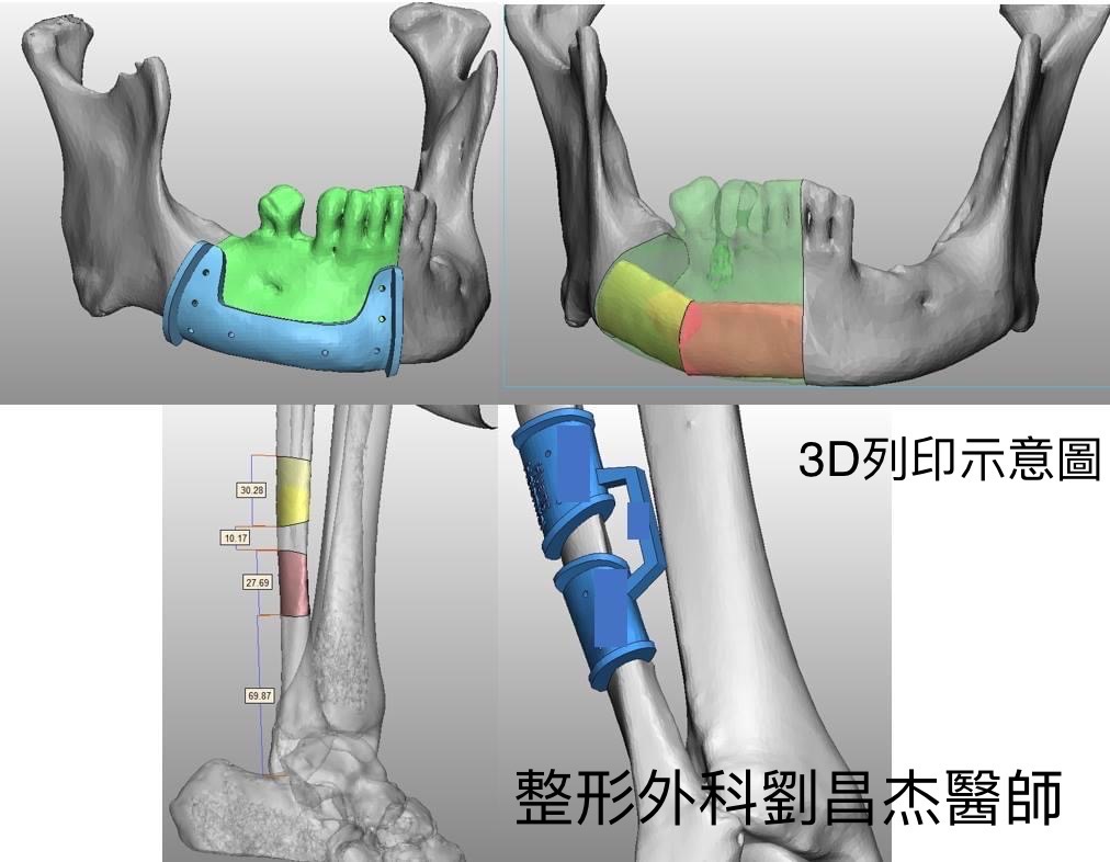 Dr Liu Blog-h5_b