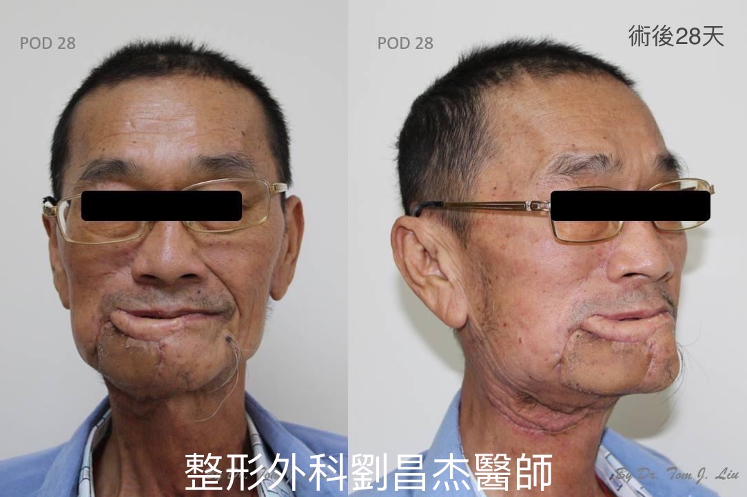 Dr Liu Blog-h5_e