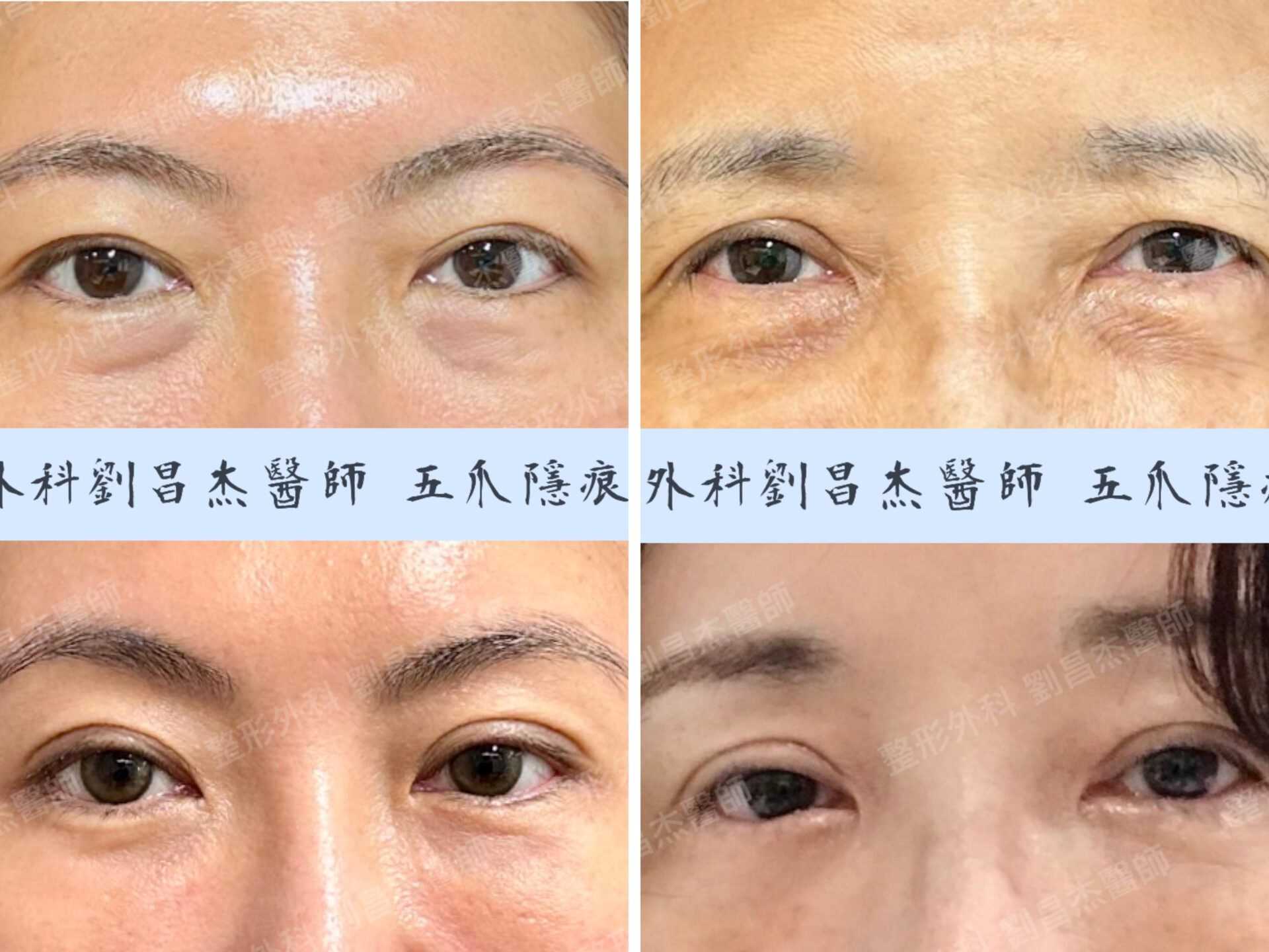 C5 5 F(封面)