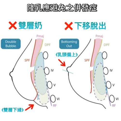 D2 9 B