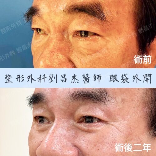 C2 5d