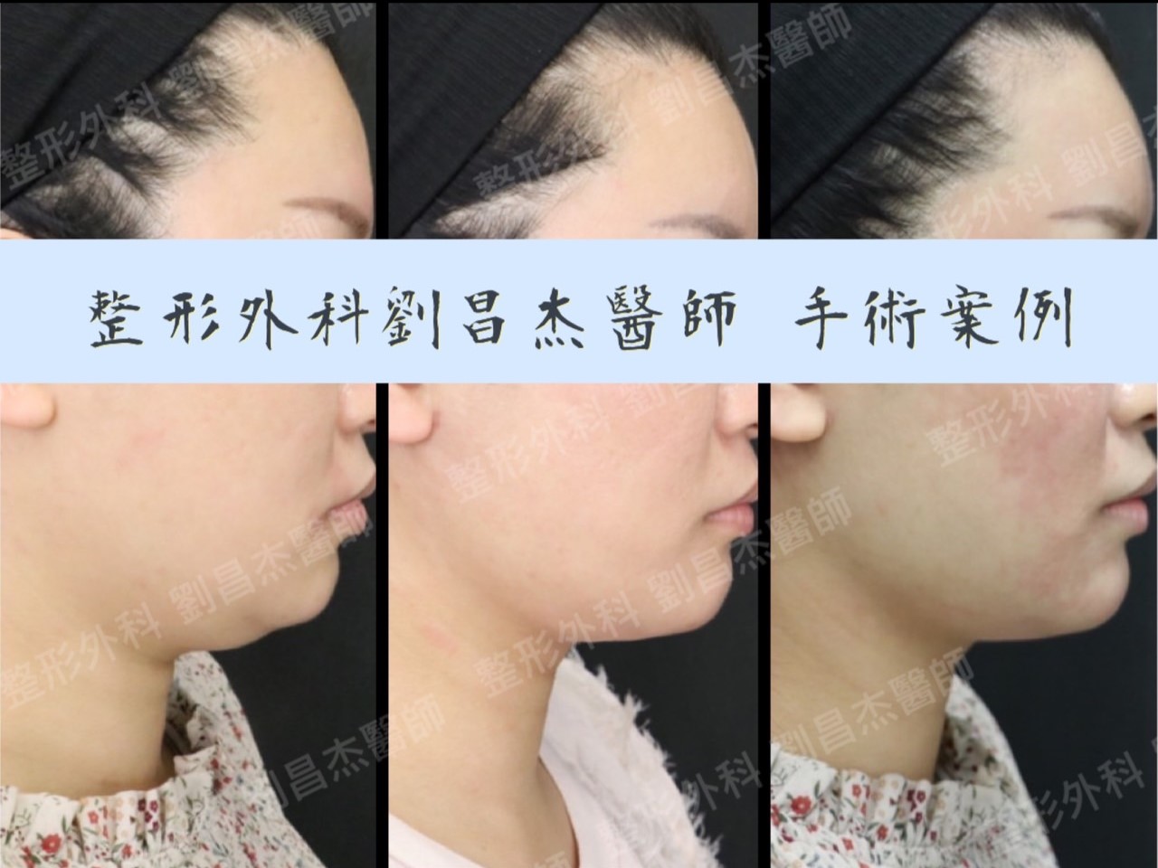 C5 6 (封面)