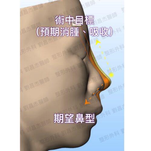 G5 1c