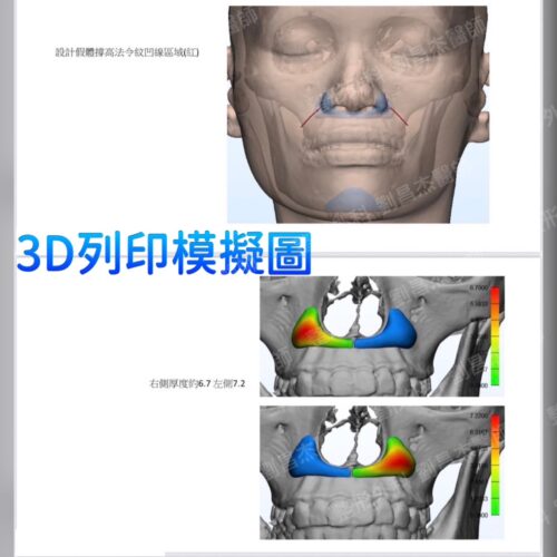 C3 14 d