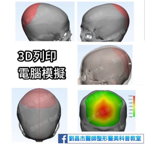 G8 4 b