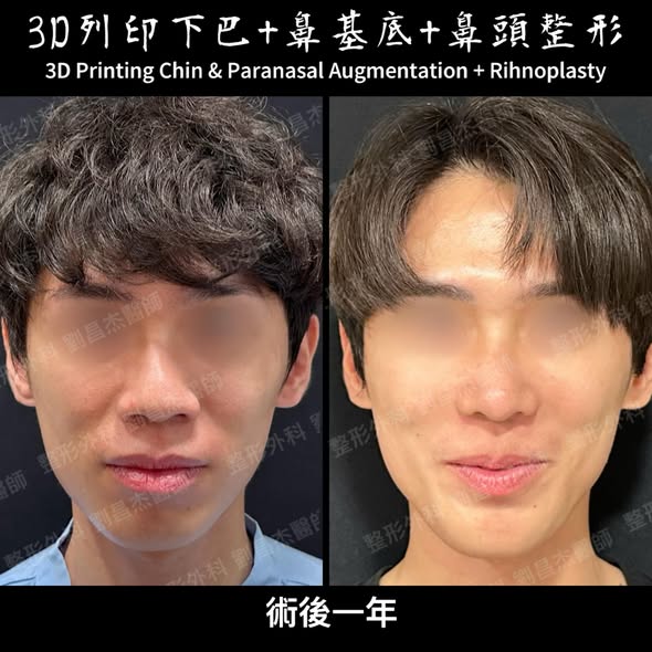 20250805 a