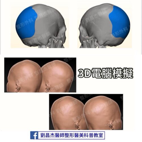 20251003 d