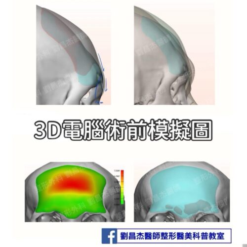 20260319 b
