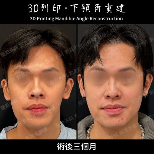 20260327 a